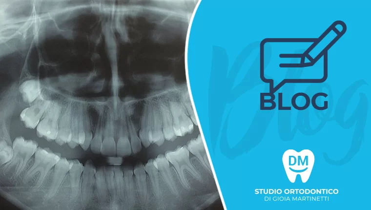 STUDIO DEL CASO ORTODONTICO