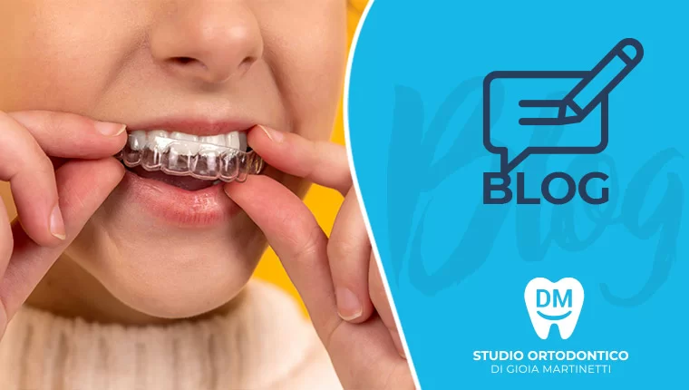 MA SI CURANO LE CARIE DEI BAMBINI?