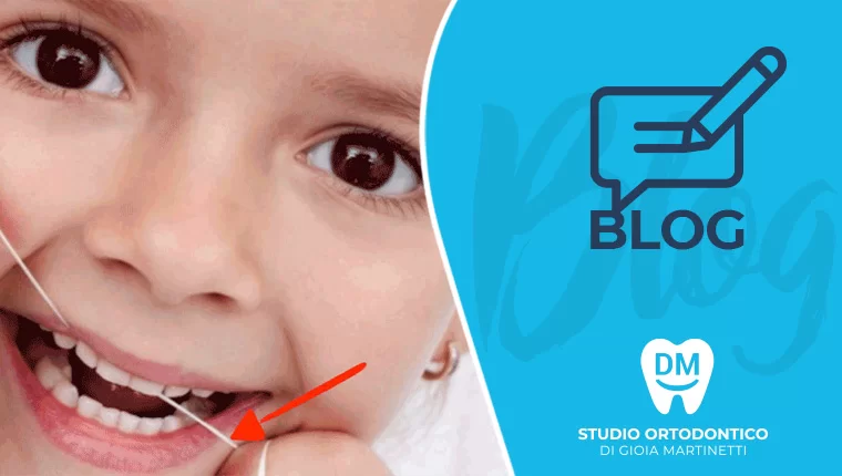 COME LAVARE I DENTI CON LO SPAZZOLINO ELETTRICO?