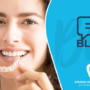 Chiusura diastemi o spazi tra i denti: come trattarli con gli allineatori trasparenti