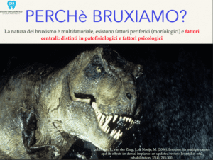 Digrignare i Denti nel Sonno: Cos'&egrave; il Bruxismo Infantile?