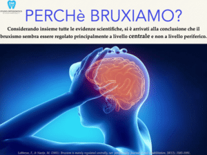 Digrignare i Denti nel Sonno: Cos'&egrave; il Bruxismo Infantile?