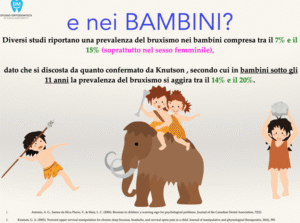 Digrignare i Denti nel Sonno: Cos'&egrave; il Bruxismo Infantile?