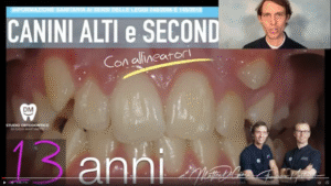 Prezzi e costi allineatori trasparenti