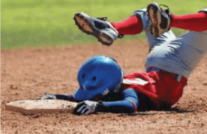 sport apparecchio allineatori