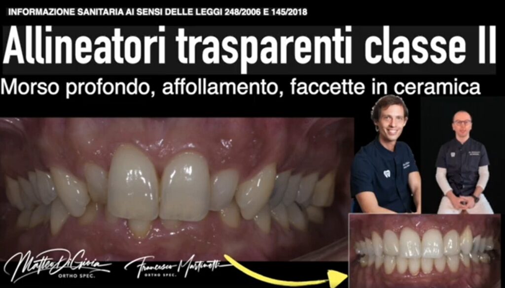 MORSO PROFONDO